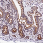 Immunohistochemical staining of human duodenum shows moderate granular cytoplasmic positivity in glandular cells.
