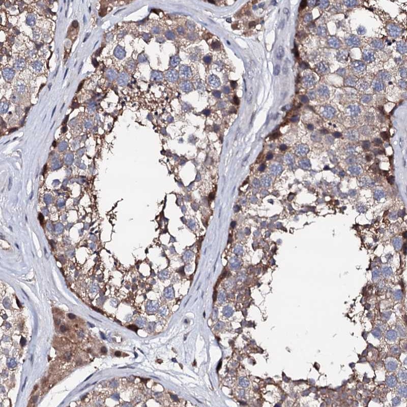 Anti-EDC3 Antibody