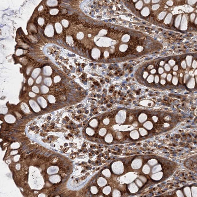 Anti-ANKRD26 Antibody