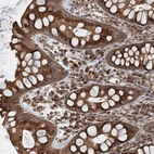 Anti-ANKRD26 Antibody