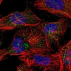 Immunofluorescent staining of human cell line U-251 MG shows localization to the Golgi apparatus & vesicles.