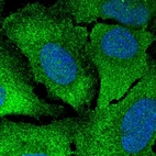 Immunofluorescent staining of human cell line U-2 OS shows localization to plasma membrane & cytosol.