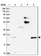Lane 1: Marker [kDa] 250, 130, 95, 72, 55, 36, 28, 17, 10_br/_Lane 2: Human cell line RT-4_br/_Lane 3: Human cell line U-251MG sp_br/_Lane 4: Human plasma (IgG/HSA depleted)_br/_Lane 5: Human liver tissue