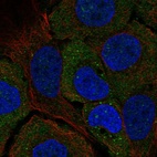 Immunofluorescent staining of human cell line HaCaT shows localization to cytosol & vesicles.