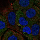 Immunofluorescent staining of human cell line HaCaT shows localization to cytosol & vesicles.