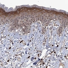 Immunohistochemical staining of human skin shows moderate cytoplasmic positivity in squamous epithelial cells.