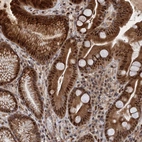 Immunohistochemical staining of human stomach shows strong cytoplasmic and nuclear positivity in glandular cells.
