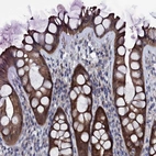 Immunohistochemical staining of human rectum shows high expression.