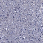 Immunohistochemical staining of human pancreas shows low expression as expected.