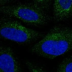 Immunofluorescent staining of human cell line U-2 OS shows localization to cytosol.