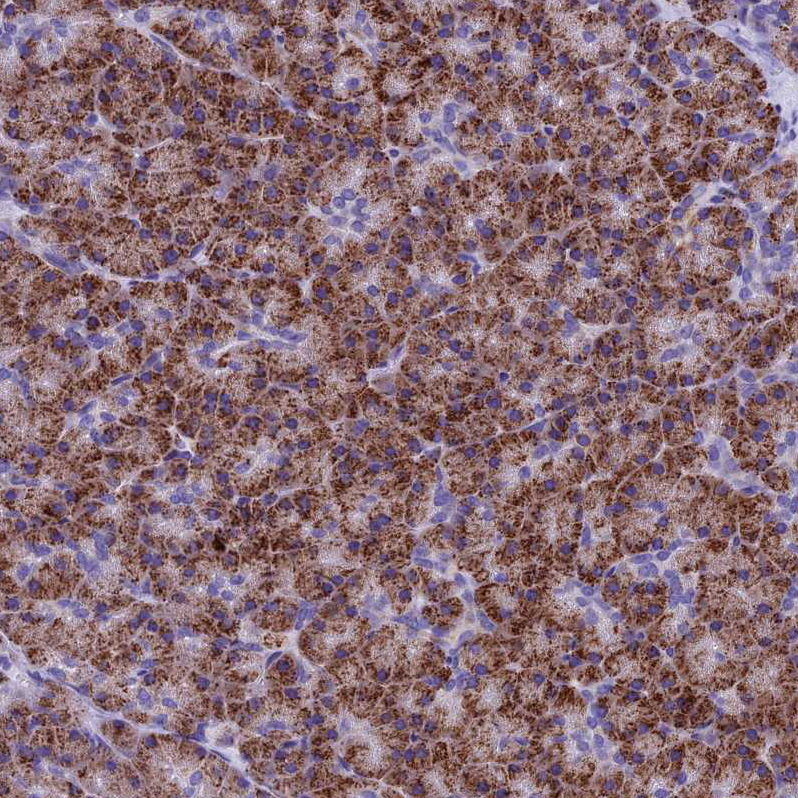 Anti-SLC8B1 Antibody