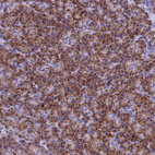 Anti-SLC8B1 Antibody