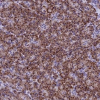 Anti-SLC8B1 Antibody