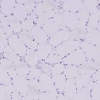 Immunohistochemical staining of human skeletal muscle shows no positivity in myocytes as expected.
