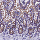 Immunohistochemical staining of small intestine shows strong granular cytoplasmic positivity in glandular cells.