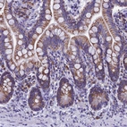 Immunohistochemical staining of small intestine shows strong granular cytoplasmic positivity in glandular cells.