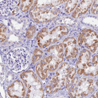 Immunohistochemical staining of human kidney shows moderate granular cytoplasmic positivity in cells in tubules.