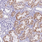 Immunohistochemical staining of human kidney shows moderate granular cytoplasmic positivity in cells in tubules.