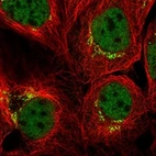 Anti-GOLGA4 Antibody