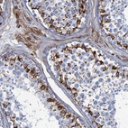 Anti-PGM2 Antibody