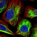 Immunofluorescent staining of human cell line U-2 OS shows localization to intermediate filaments.