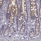 Immunohistochemical staining of human duodenum shows moderate cytoplasmic positivity in glandular cells.