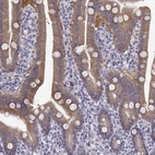 Immunohistochemical staining of human small intestine shows moderate cytoplasmic positivity in glandular cells.