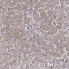 Immunohistochemical staining of human liver shows weak cytoplasmic positivity in hepatocytes.