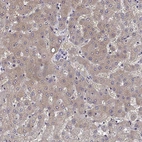 Immunohistochemical staining of human liver shows weak cytoplasmic positivity in hepatocytes.