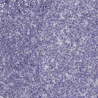Immunohistochemical staining of human tonsil shows no positivity in lymphoid cells as expected.