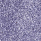 Immunohistochemical staining of human tonsil shows no positivity in lymphoid cells as expected.