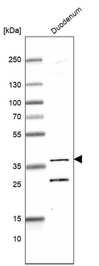 Western blot analysis in human duodenum tissue.