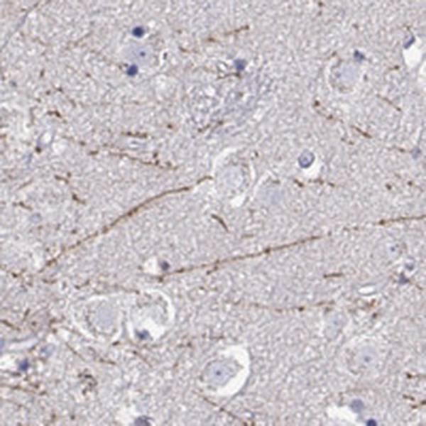 Anti-DCLK3 Antibody