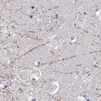 Anti-DCLK3 Antibody