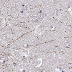 Anti-DCLK3 Antibody