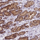 Anti-HPS6 Antibody