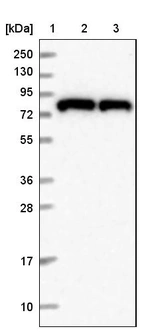 Lane 1: Marker [kDa] 250, 130, 95, 72, 55, 36, 28, 17, 10_br/_Lane 2: Human cell line RT-4_br/_Lane 3: Human cell line U-251MG sp