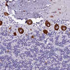 Immunohistochemical staining of human cerebellum shows strong cytoplasmic positivity in Purkinje cells.