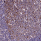 Immunohistochemical staining of human tonsil shows moderate membranous and cytoplasmic positivity in germinal center cells.