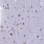 Immunohistochemical staining of human cerebral cortex shows strong cytoplasmic positivity in neurons.