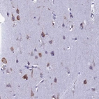 Immunohistochemical staining of human cerebral cortex shows strong cytoplasmic positivity in neurons.