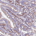 Immunohistochemical staining of human duodenum shows moderate cytoplasmic positivity in glandular cells.