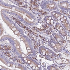 Immunohistochemical staining of human duodenum shows moderate cytoplasmic positivity in glandular cells.