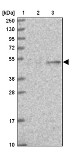 Lane 1: Marker [kDa] 250, 130, 95, 72, 55, 36, 28, 17, 10_br/_Lane 2: Human cell line RT-4_br/_Lane 3: Human cell line U-251MG sp