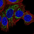 Immunofluorescent staining of human cell line MCF7 shows localization to mitochondria.