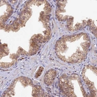 Anti-HDHD2 Antibody