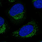 Immunofluorescent staining of human cell line U-2 OS shows localization to vesicles.