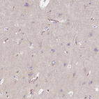 Anti-VPS18 Antibody
