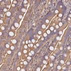 Immunohistochemical staining of human small intestine shows moderate cytoplasmic positivity in glandular cells.
