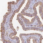 Immunohistochemical staining of human fallopian tube shows moderate cytoplasmic positivity in glandular cells.